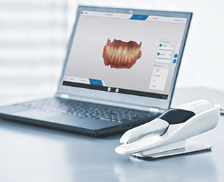 デジタルスキャナー